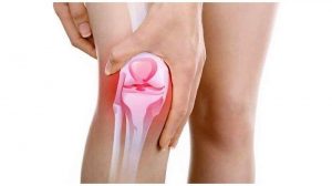 Read more about the article Osteoarthritis : Sakit Sendi Yang Menyiksa