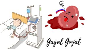 Read more about the article Kegagalan Yang Akan Menghantui Anda Seumur Hidup