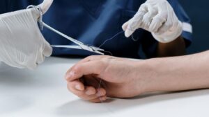 Read more about the article Ozone Therapy for Wound, Fast, Painless & Effective Healers with Anti-Inflammation